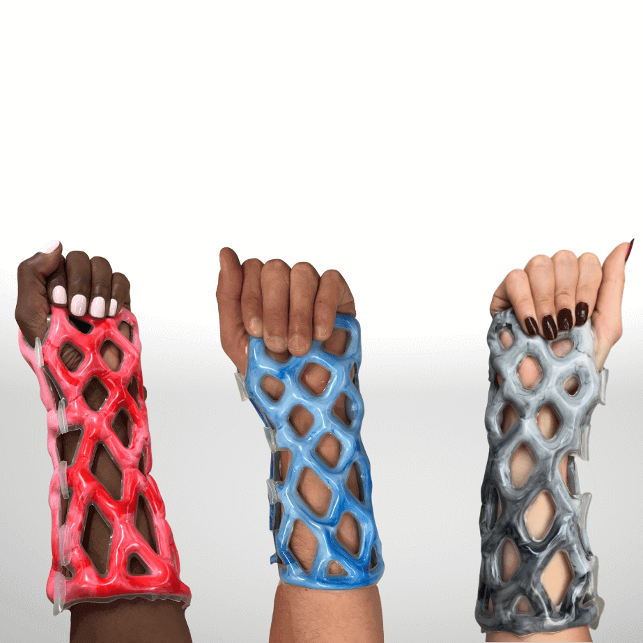 Breathable lattice cast for broken arms