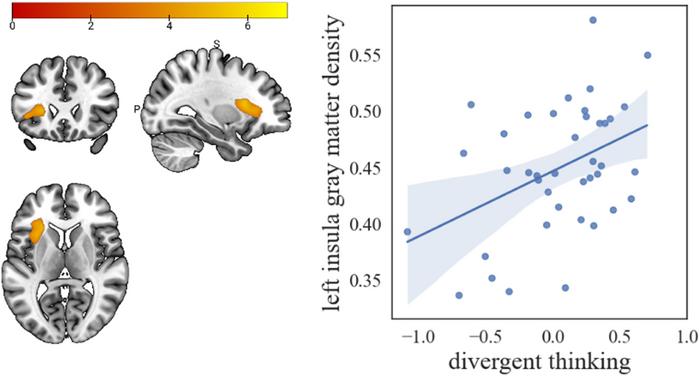 (Left) Increase in gray matter volume in the left insula in habitual entrepreneurs compared to managers. Significant clusters are shown on the brain template. The color bar illustrates the corresponding t value. (Right) Correlation plots of left insula gray matter density and the normalized score for divergent thinking. The shaded area represents a 95% confidence interval around the regression line. CREDIT @JBVI/University of Liège