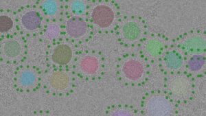 Experimental electron micrograph of purified synaptic vesicles (upper). Synaptic vesicles automatically identified in the image with a new computer program are highlighted with different colours and candidate positions for V-ATPase are indicated with green dots. CREDIT: THE HOSPITAL FOR SICK CHILDREN (SICKKIDS).