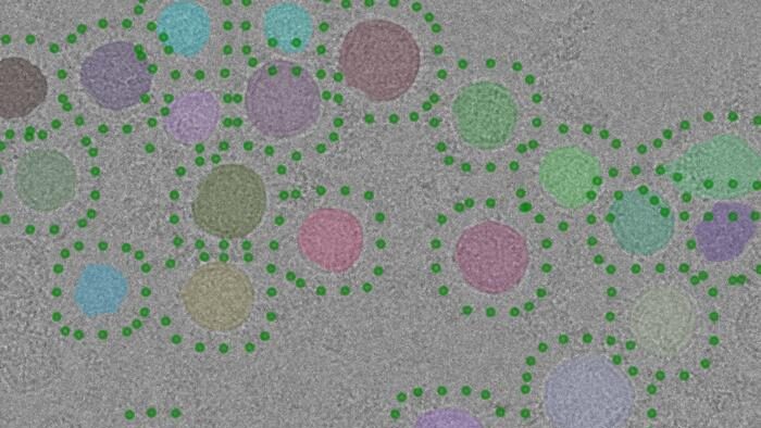 Experimental electron micrograph of purified synaptic vesicles (upper). Synaptic vesicles automatically identified in the image with a new computer program are highlighted with different colours and candidate positions for V-ATPase are indicated with green dots. CREDIT: THE HOSPITAL FOR SICK CHILDREN (SICKKIDS).