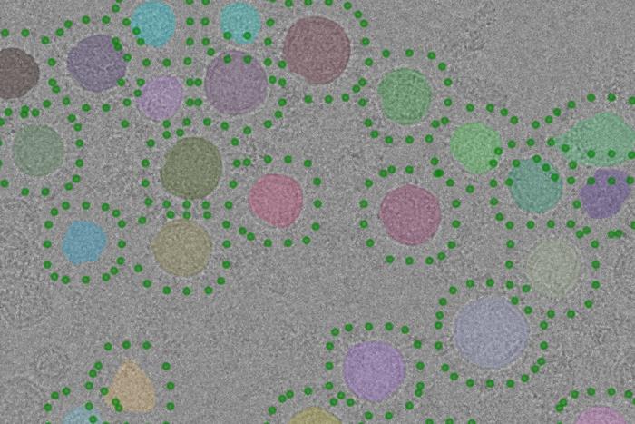 Experimental electron micrograph of purified synaptic vesicles (upper). Synaptic vesicles automatically identified in the image with a new computer program are highlighted with different colours and candidate positions for V-ATPase are indicated with green dots. CREDIT: THE HOSPITAL FOR SICK CHILDREN (SICKKIDS).