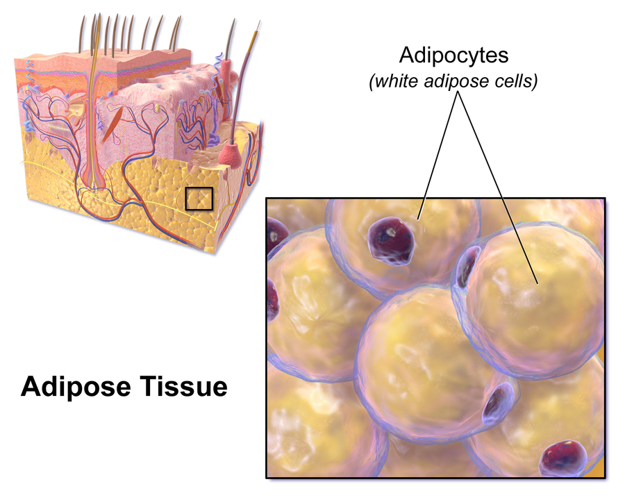 Depiction of White fat cells (white adipose cells) added by Superinnovators. Credit: By BruceBlaus. Blausen.com staff (2014). 