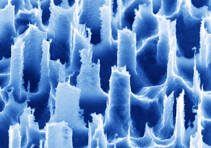 Breakthrough device detects airborne signs of disease