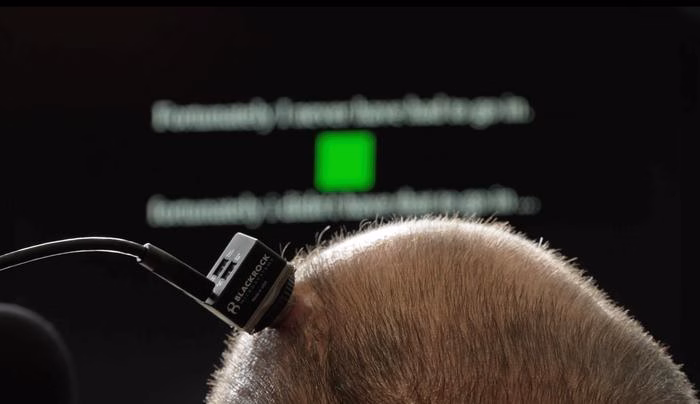 First-of-its-kind technology helps man with ALS ‘speak’ in real time