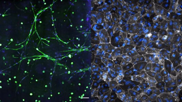 Lymph node on a chip: New immune system model may enhance precision medicine research
