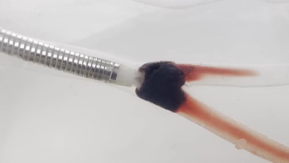Tiny device spins blood clots away